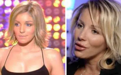 myriam abel chirurgie esthétique
