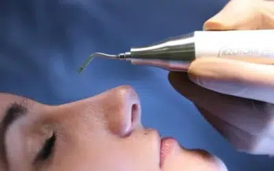 Rhinoplastie ultrasonique dr gerbault