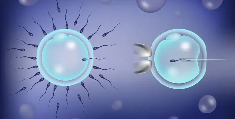 Fécondation in vitro