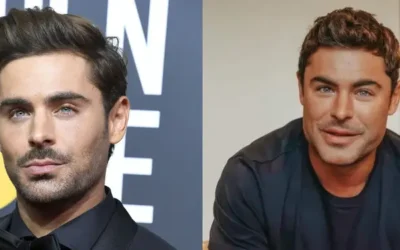 zac efron chirurgie Zac Efron chirurgie esthétique