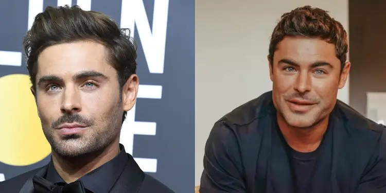 Zac Efron chirurgie esthétique