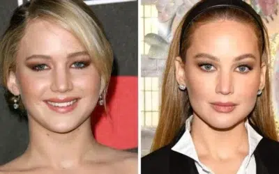 Jennifer Lawrence chirurgie esthetique rumeurs Jennifer Lawrence chirurgie esthétique