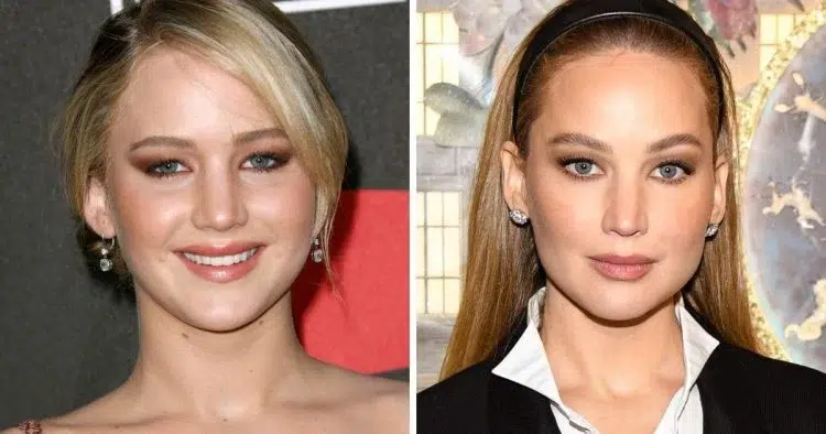 Jennifer Lawrence chirurgie esthétique