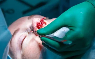 La chirurgie esthetique est elle douloureuse Douleur La chirurgie esthétique est elle douloureuse ?