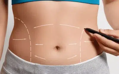 Quel est le cout dune liposuccion Quel est le coût d’une liposuccion ?
