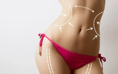 chirurgie esthetique tunisie prix Chirurgie esthétique tunisie prix