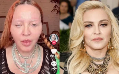 madonna chirurgie esthetique visage Madonna chirurgie esthétique