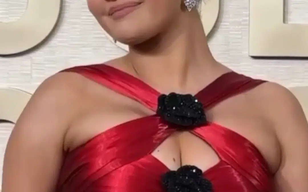 Selena Gomez chirurgie esthétique