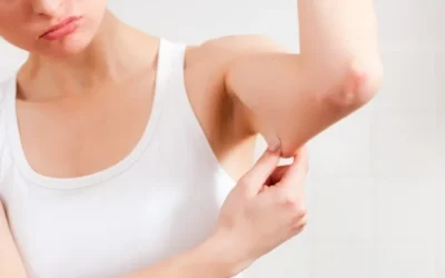 Liposuccion bras estetika Tour Liposuccion bras tarif
