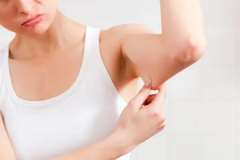 Liposuccion bras tarif