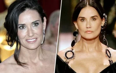 demi moore chirurgie Demi moore chirurgie