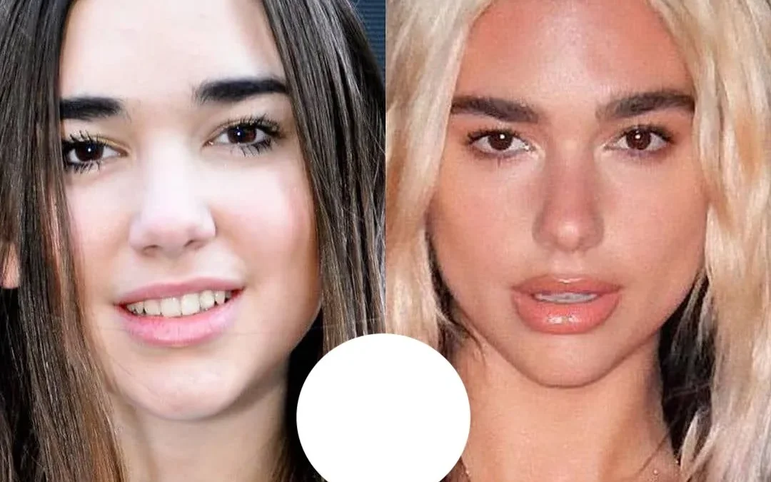 Dua Lipa chirurgie