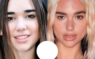 Dua Lipa chirurgie Dua Lipa chirurgie