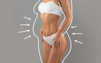 Liposucccion tunisie avant apres Liposuccion tunisie avant après
