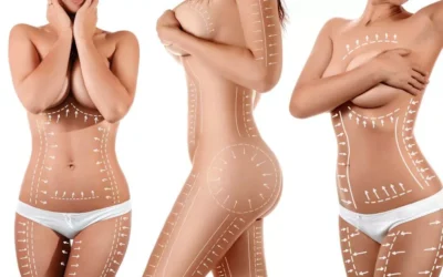 Quel est le prix moyen dune liposuccion Quel est le prix moyen d’une liposuccion ?