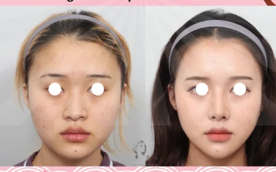 Chirurgie esthetique en coree du sud Chirurgie esthetique en corée du sud