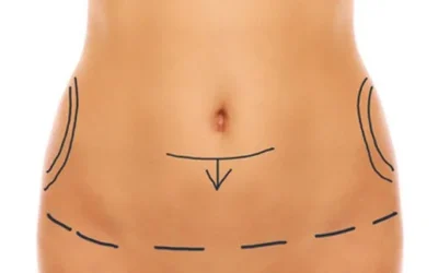 Chirurgie esthetique laval Chirurgie esthétique laval
