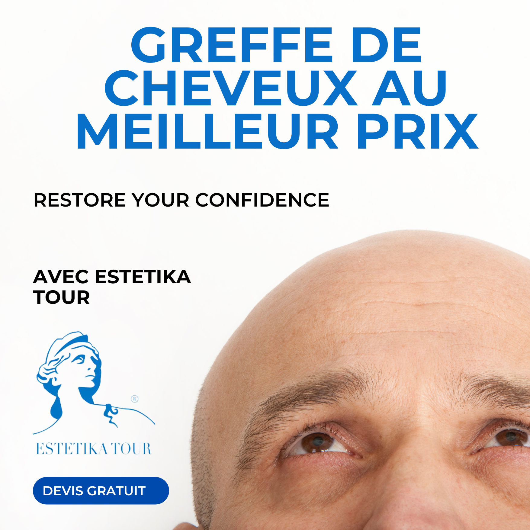 Greffe de cheveux turquie, Greffe de cheveux prix tunisie