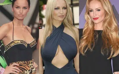 Adriana Karembeu chirurgie esthetique visage Adriana Karembeu chirurgie esthétique