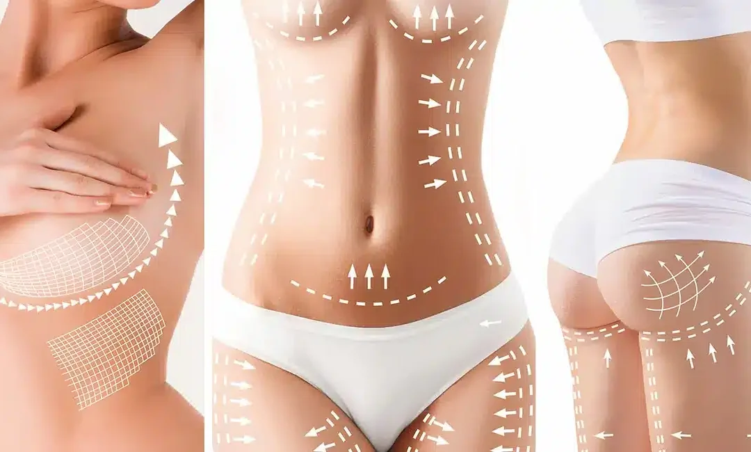 Chirurgie esthétique québec