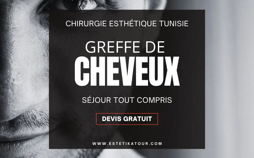 greffe de cheveux tunisie prix