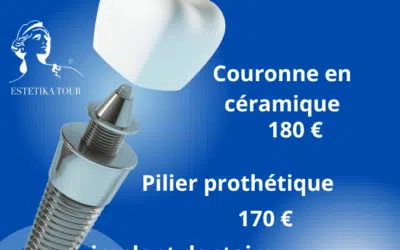 Couronne en ceramique Temps de cicatrisation d’un implant dentaire