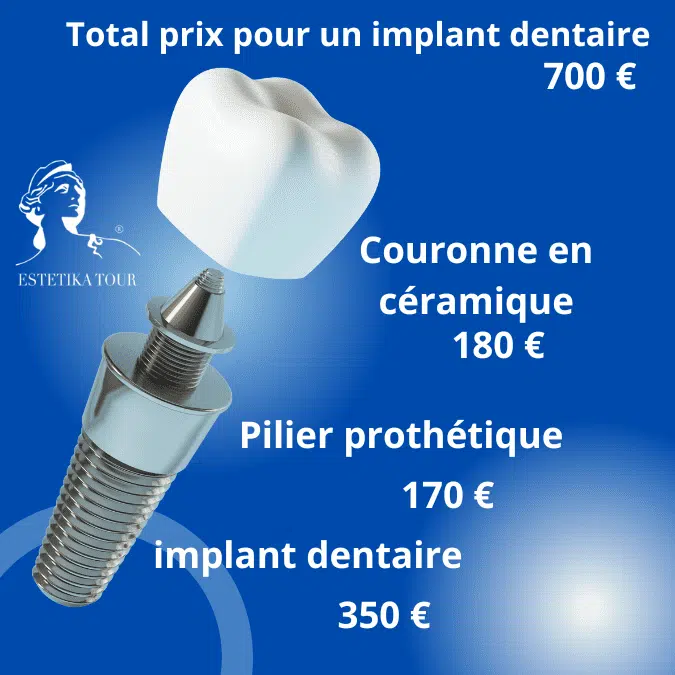 Temps de cicatrisation d’un implant dentaire