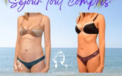 Lipo tunisie Lipo tunisie