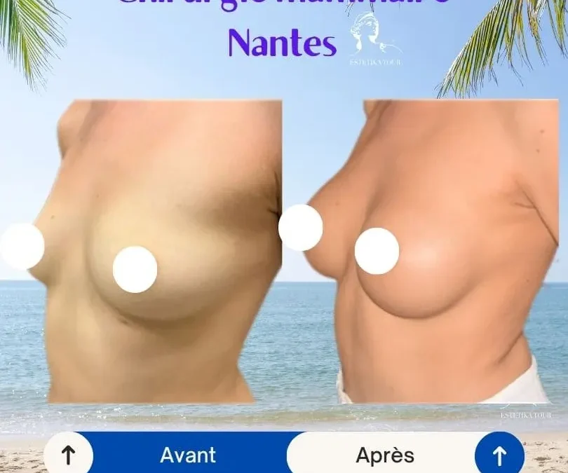 Augmentation mammaire prix nantes
