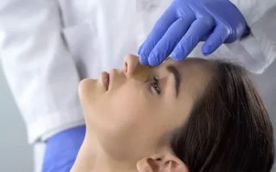 Quel type de rhinoplastie vous faut-il ?