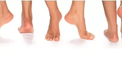 chirurgie esthetique pied prix Chirurgie esthétique pied prix