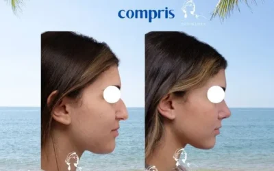 Meilleur chirurgien rhinoplastie france