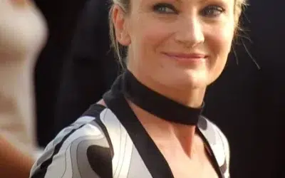 Patricia Kaas chirurgie esthétique​