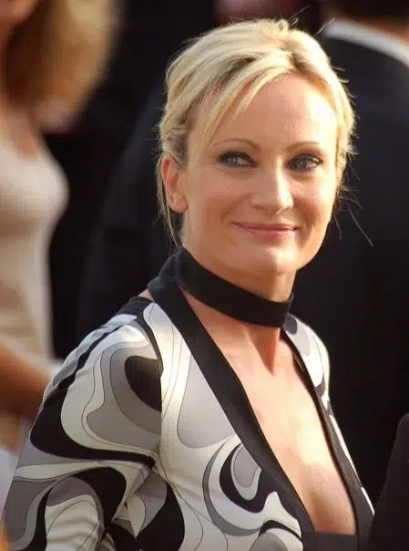 Patricia Kaas chirurgie esthétique​