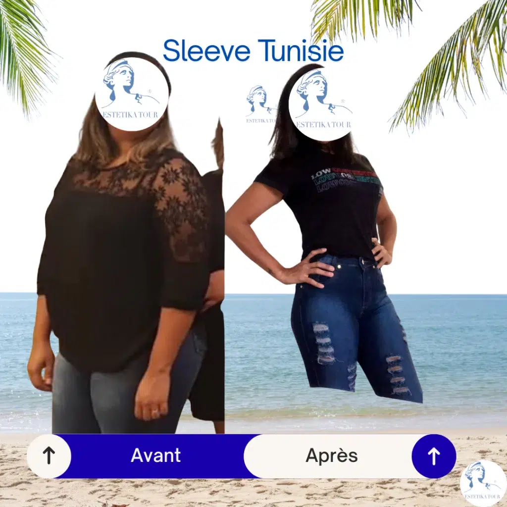 Sleeve Tunisie