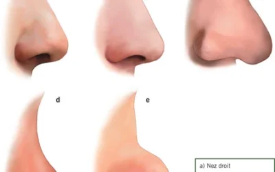 nez aquilin Nez Aquilin