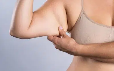 Liposuccion bras prix Liposuccion bras prix