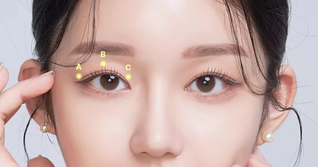 쌍꺼풀 수술 쌍꺼풀 수술, blépharoplastie asie , chirurgie des yeux asiatique